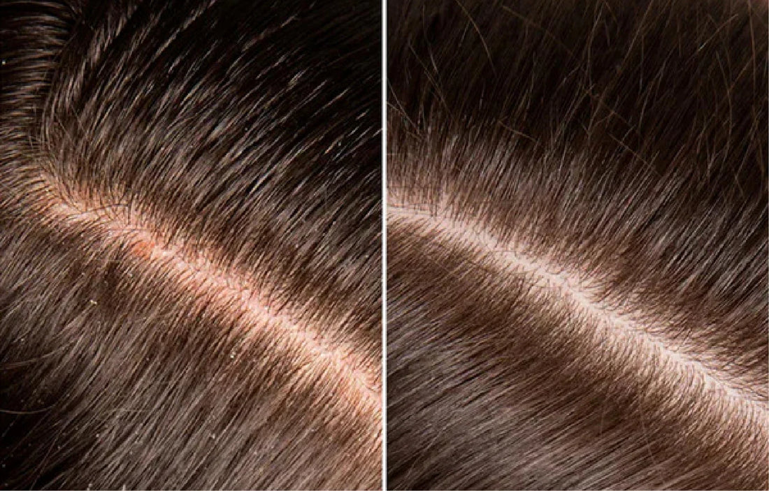 <strong>Vecka 2  Minskad oljighet och bättre balans</strong>