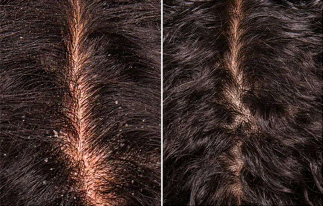 <strong>Vecka 4  Tydligt minskad mjäll och irritation</strong>