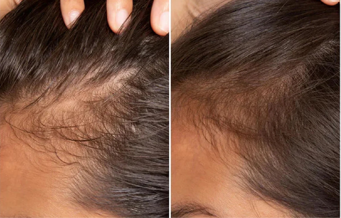 <strong>Vecka 8  Förbättrad hårväxt och starkare hårstruktur</strong>