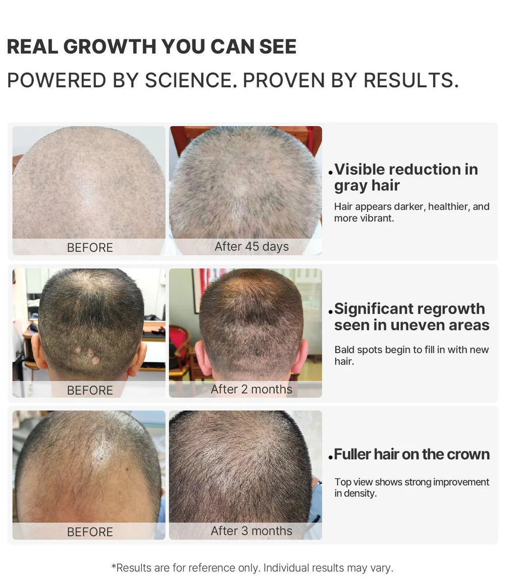 VITA Graphene Scalp Pro