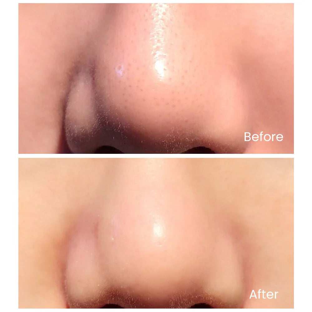 Glow – Ultrasonic Skin Scrubber