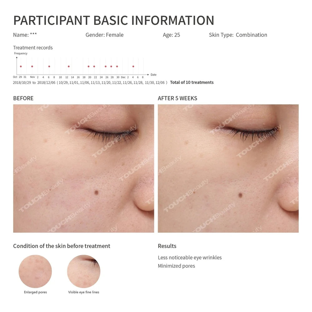 <strong>Sonic vibrations­teknologi</strong>