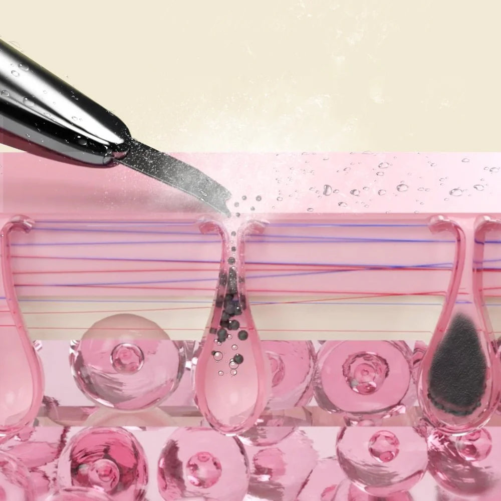 <strong>Exfolieringsläge</strong>